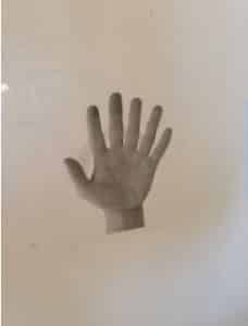 main à 6 doigts